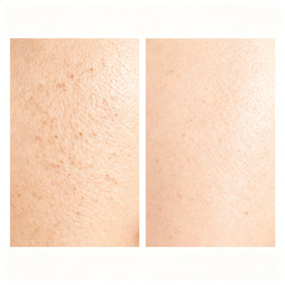 Before-and-after skin comparison using the NovaPeel Ultrasonic Skin Scrubber